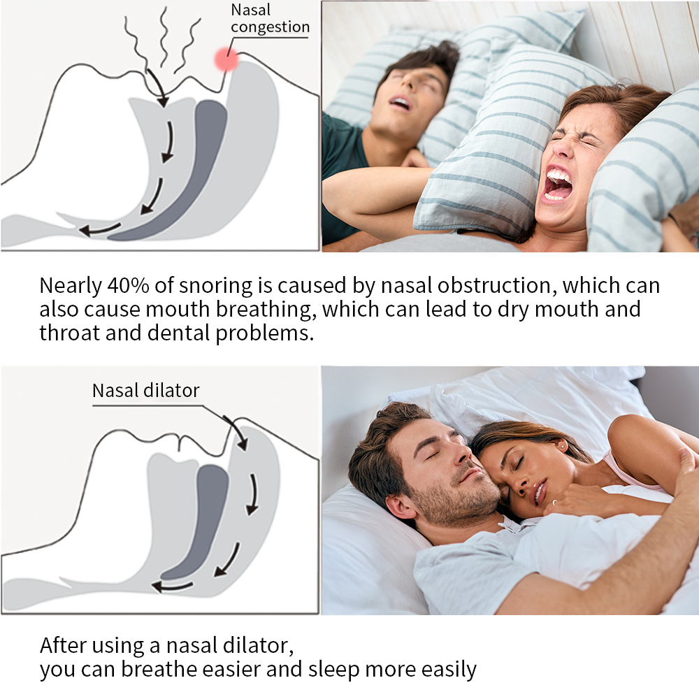 1PC Sleeping Aid Silicone Anti-Snoring Device Snore Stop 4